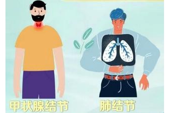 身体有结节？不要慌！这些天然“散结方”赶快学起来